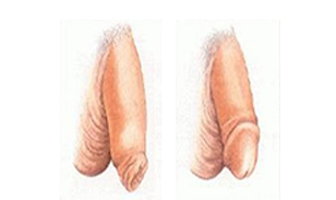 喀什博大男科醫院