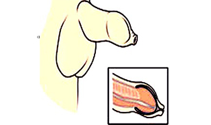 喀什博大男科醫院