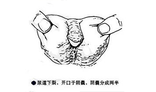 喀什博大男科醫院