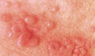 喀什博大男科醫院