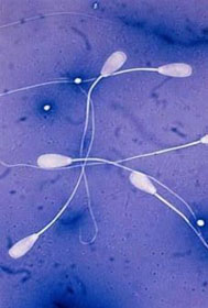 生活中哪些因素會殘害男性精子?