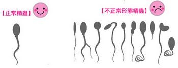 精子畸形的病因是什么?